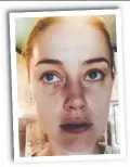  ??  ?? Amber Heard photo shown in court.