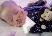  ?? PHOTO FACEBOOK ?? Charlie Gard, 11 mois, est atteint d’une maladie rare qui affecte sa respiratio­n.