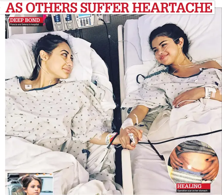  ??  ?? Francia and Selena in hospital Operation scar on her stomach HEALING DEEP BOND