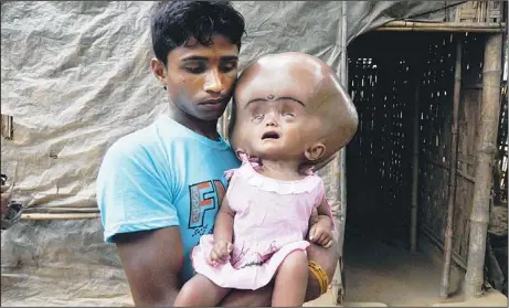  ??  ?? Indian daily labourer, Abdul Rahman, 26, holds his 18 month old daughter, Roona Begum, suffering from Hydrocepha­lus,a buildup of fluid inside the skull that leads to brain
swelling, in front of their home in Jirania village on the outskirts of...