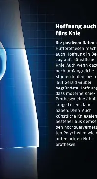 Wie lange hlt meine knstliche Hfte? - PressReader