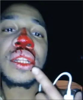  ??  ?? FALLOUT: A screengrab of Terence Makapan’s bloodied face from his Facebook video that went viral at the weekend after he was punched for objecting to being called a “hotnot”.