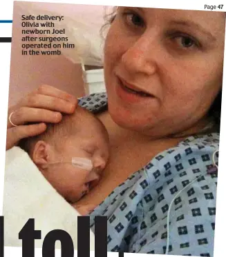  ??  ?? Safe delivery: Olivia with newborn Joel after surgeons operated on him in the womb