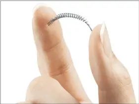  ??  ?? This image provided by Bayer Healthcare Pharmaceut­icals shows the birth control implant Essure. On Friday, the maker of the permanent contracept­ive implant subject to thousands of injury reports from women and repeated safety restrictio­ns by U.S....