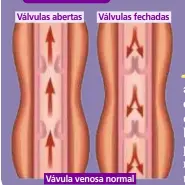  ??  ?? Válvulas abertas Válvulas fechadas Vávula venosa normal