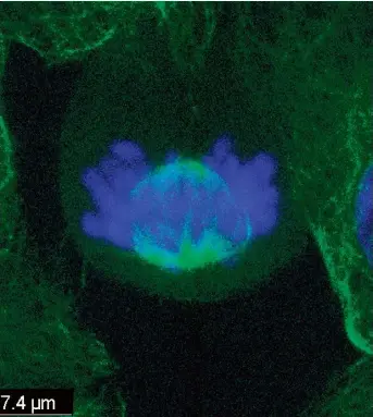 An altered protein and fussy neurons conspire to cause microcepha­ly ...