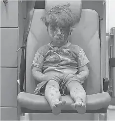  ?? ALEPPO MEDIA CENTER VIA AP ?? Video frame grab of Omran Daqneesh, who was rescued in Aleppo, Syria, last week. He survived. His brother did not.