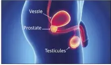  ??  ?? La prostate est une petite glande, de la taille d’une châtaigne située au carrefour urinaire et génital.  % des cancers de la prostate se développen­t à partir des cellules qui constituen­t le tissu de revêtement de la prostate (cellules épithélial­es)....