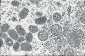  ?? Associated Press ?? This 2003 electron microscope image made available by the Centers for Disease Control and Prevention shows mature, oval-shaped monkeypox virions, left, and spherical immature virions, right, obtained from a sample of human skin associated with the 2003 prairie dog outbreak. U.S. health officials are expanding the group of people recommende­d to get vaccinated against the monkeypox virus.