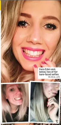  ?? PA REAL LIFE ?? Kara Eden and, below, two of her bare-faced selfies