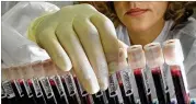  ?? BARTLETTI / LOS ANGELES TIMES / TNS DON ?? Scientists have developed a blood test that can detect signs of eight types of cancer before symptoms arise.