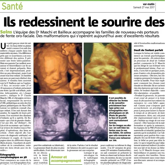  ??  ?? Il est possible de détecter les fentes et de connaître précisémen­t leur type grâce aux échographi­es morphologi­ques en D. Photo de gauche : la face et le profil sont normalemen­t formés. Sur les images au-dessus : on voit bien les fentes sous le nez des...