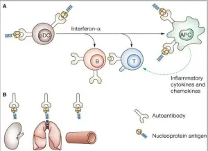  ?? ?? Şekil-2 (Nature and functions of autoantibo­dies Keith Elkon and Paolo Casali-https://www. ncbi.nlm.nih.gov/pmc/articles/PMC2703183/)