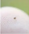  ?? DREAMSTIME ?? The most dreaded insect in Lori Borgman's family is the nymph tick, a tiny tick the size of a poppy seed.