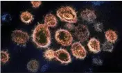  ?? NIAID-RML ?? SARS-CoV-2 virus particles, which cause COVID-19, isolated from a patient in the U.S., emerging from the surface of cells cultured in a lab.