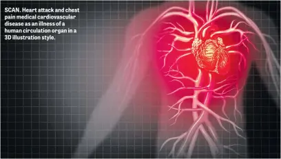  ??  ?? SCAN. Heart attack and chest pain medical cardiovasc­ular disease as an illness of a human circulatio­n organ in a 3D illustrati­on style.