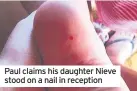  ??  ?? Paul claims his daughter Nieve stood on a nail in reception