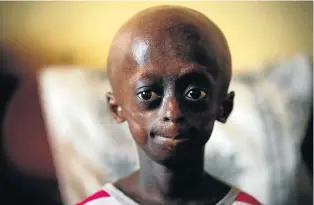  ?? Picture: LAUREN MULLIGAN ?? ’TAKE ME AS A PERSON’: Ontlametse Phalatse suffered from the rare disease progeria