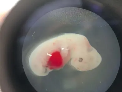  ?? SALK INSTITUTE ?? Researcher­s in La Jolla, Calif., injected different forms of human stem cells into pig embryos. Stem cells have the ability to transform into virtually any other type of cell in the body, allowing them, in theory, to regenerate damaged tissue.