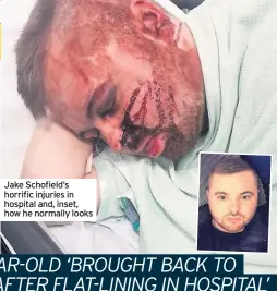  ??  ?? Jake Schofield’s horrific injuries in hospital and, inset, how he normally looks