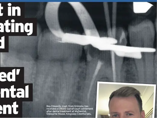 ??  ?? Ray Edwards, inset, from Grimsby, has received a £9000 out-of-court settlement after dental treatment at MyDentist, Osbourne House, Kingsway Cleethorpe­s.