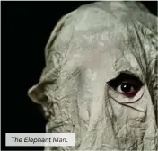  ??  ?? The Elephant Man.