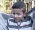  ??  ?? 7-year-old Hassan has new, geneticall­y modified skin on almost all of his body.