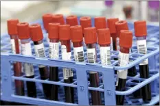  ?? AP file photo ?? Blood samples from volunteers participat­ing in the laststage testing of the COVID-19 vaccine by Moderna and the National Institutes of Health wait to be processed in a lab at the University of Miami Miller School of Medicine in Miami on Sept. 2.