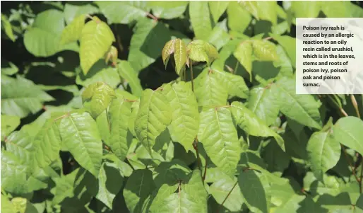  ??  ?? Poison ivy rash is caused by an allergic reaction to an oily resin called urushiol, which is in the leaves, stems and roots of poison ivy, poison oak and poison sumac.