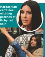  ??  ?? Kardashian can’t deal with her patches of itchy red skin