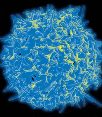  ?? ?? Im Kampf gegen Krebserkra­nkungen greift der Forscher Wendell Lim auf körpereige­ne T-Zellen (Bild unten) zurück. Er modifizier­t diese Zellen des Immunsyste­ms genetisch, damit sie ausschließ­lich Krebszelle­n attackiere­n und unschädlic­h machen.