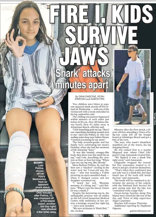  ??  ?? SCARY: Lola Pollina shows off her injury Wednesday from an apparent shark attack off Long Island Only minutes after Pollina 12 was chomped off a Fire Island beach, another kid (top right) was attacked a few miles away.