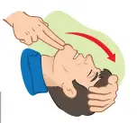  ??  ?? Tilt the head back to re-open the airway. See step 5