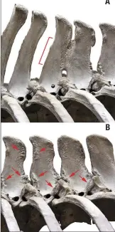  ??  ?? “Kissing spines” of thoracics 12-13 in Lexington (A) has progressed to total fusion (red bracket). Note exostoses on the accessory processes as well. Lexington thoracics 14-17 (B) show exostosis of the points of attachment of the deep vertebral...