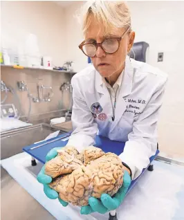  ?? ROBERT DEUTSCH/USA TODAY ?? Ann McKee, chief of neuropatho­logy at the VA Boston Healthcare System, examines a brain.