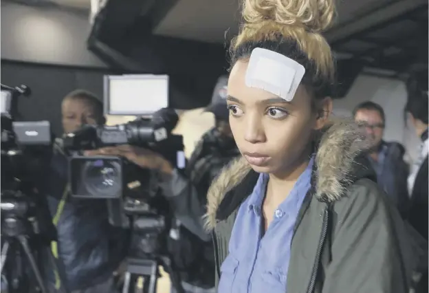  ??  ?? Gabriella Engels displays her injuries to the media yesterday, claiming she was the victim of an assault by Grace Mugabe, wife of Zimbabwe’s president Robert Mugabe