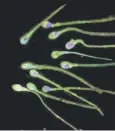  ??  ?? 0 Sperm counts are falling rapidly, research shows