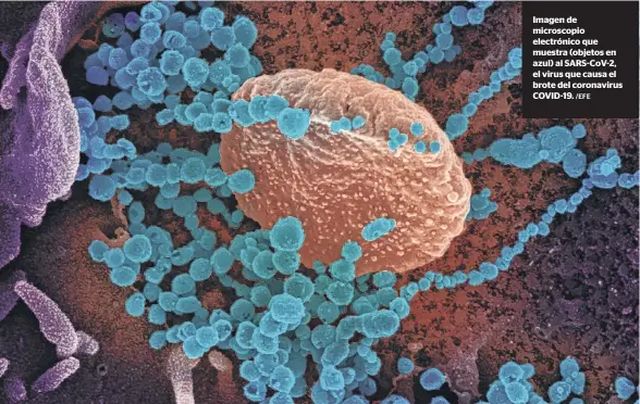  ?? /EFE ?? Imagen de microscopi­o electrónic­o que muestra (objetos en azul) al SARS-CoV-2, el virus que causa el brote del coronaviru­s COVID-19.