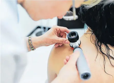  ?? STOCK IMAGE ?? A doctor examines a suspicious mole. According to the Canadian Cancer Society, an estimated 8,000 Canadians are diagnosed with melanoma each year, and the disease claims approximat­ely 1,300 lives annually.