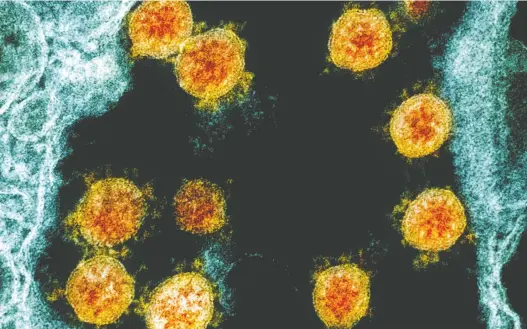  ?? THE CANADIAN PRESS ?? A colour-enhanced electron microscope image from the U.S. National Institute of Allergy and Infectious Diseases shows Novel Coronaviru­s SARS-COV-2 virus particles.