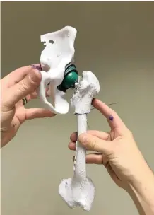  ?? STELLENBOS­CH UNIVERSITY ?? THIS is a 3D printed model of a patient’s hip joint. Surgeons used it to practise placing an implant into the joint, in order to make sure the implant was the exact correct size for the patient’s bones. |