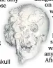  ??  ?? Joseph Merrick’s skull