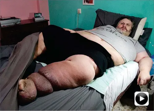  ?? A. L. ?? José María Fernández, de 49 años, reside en San Fernando (Cádiz). Lleva tres meses sin salir de la cama de su habitación, de 12 metros cuadrados.