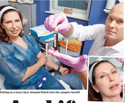  ?? Pictures:JULIETTENE­EL ?? Putting on a brace face: Amanda Platell tries the vampire facelift