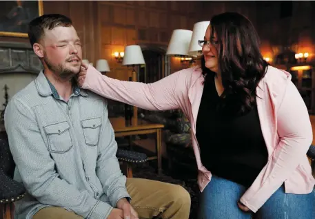 ??  ?? Lilly Ross feels the beard of face transplant recipient Andy Sandness during their meeting at the Mayo Clinic in Minnesota