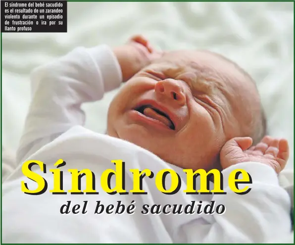 ??  ?? El síndrome del bebé sacudido es el resultado de un zarandeo violento durante un episodio de frustració­n o ira por su llanto profuso
