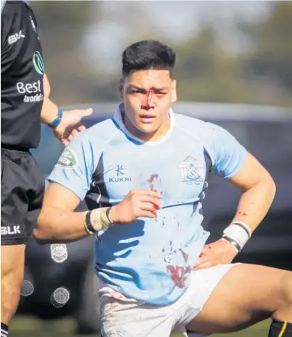  ?? Photo / Paul Taylor ?? Leo Thompson bleeds for the cause during Napier Boys’ High School 1st XV’s win against Palmerston North Boys’ High School yesterday.