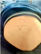  ?? ?? A photo of Hamad’s back with the Star of David cut into his back with a knife by an Israeli soldier [Courtesy of Susan Abulhawa]