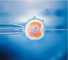  ??  ?? Así se realiza una fertilizac­ión in vitro de una célula de huevo.