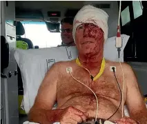  ?? PHOTO: SUPPLIED ?? Pilot Rod Vaughan says a drone crashed into his plane near Waihi, leaving him with a head injury.